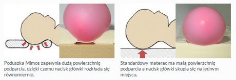 Poduszka medyczna redukująca spłaszczenie główki | Mimos - jak może powstawć zniekształcenie głowki u niemowląt